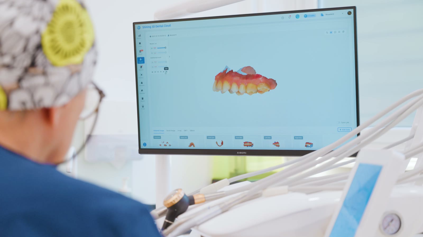 3D sken zubnog luka u CAD softveru na monitoru ordinacije