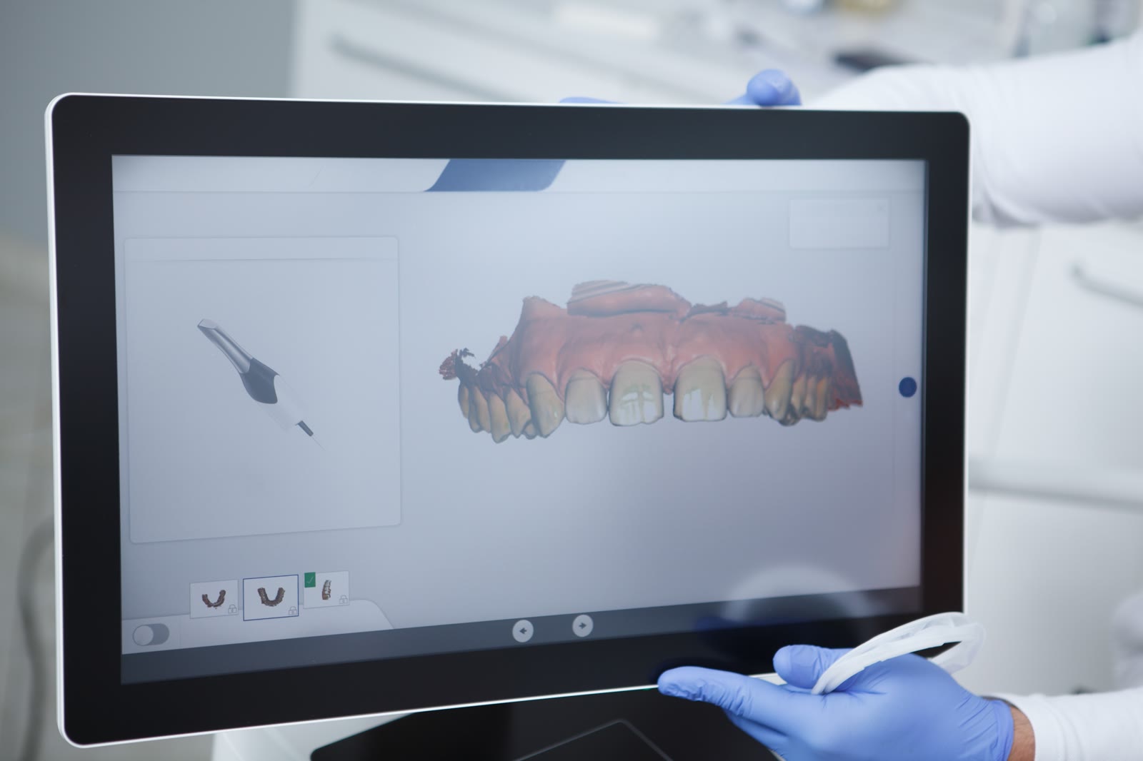3D model zuba u CAD softveru na monitoru