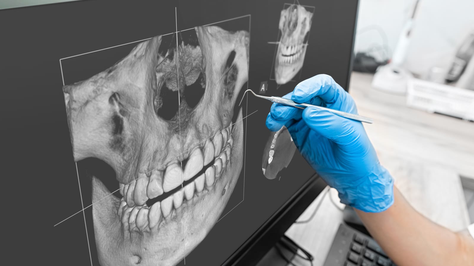 Stomatolog analizira 3D CBCT snimak vilice na ekranu